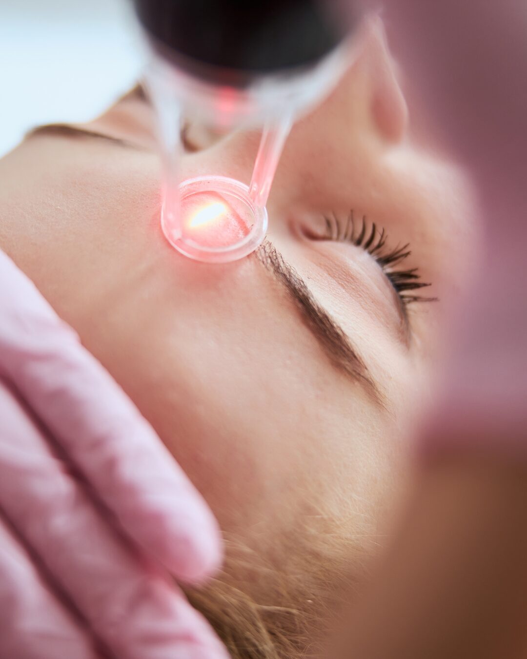 Clear + Brilliant, laser treatment, Syracuse, NY, skin rejuvenation, anti-aging, skincare, facial treatment, skin tone, wrinkles, sun damage, melasma, skin texture